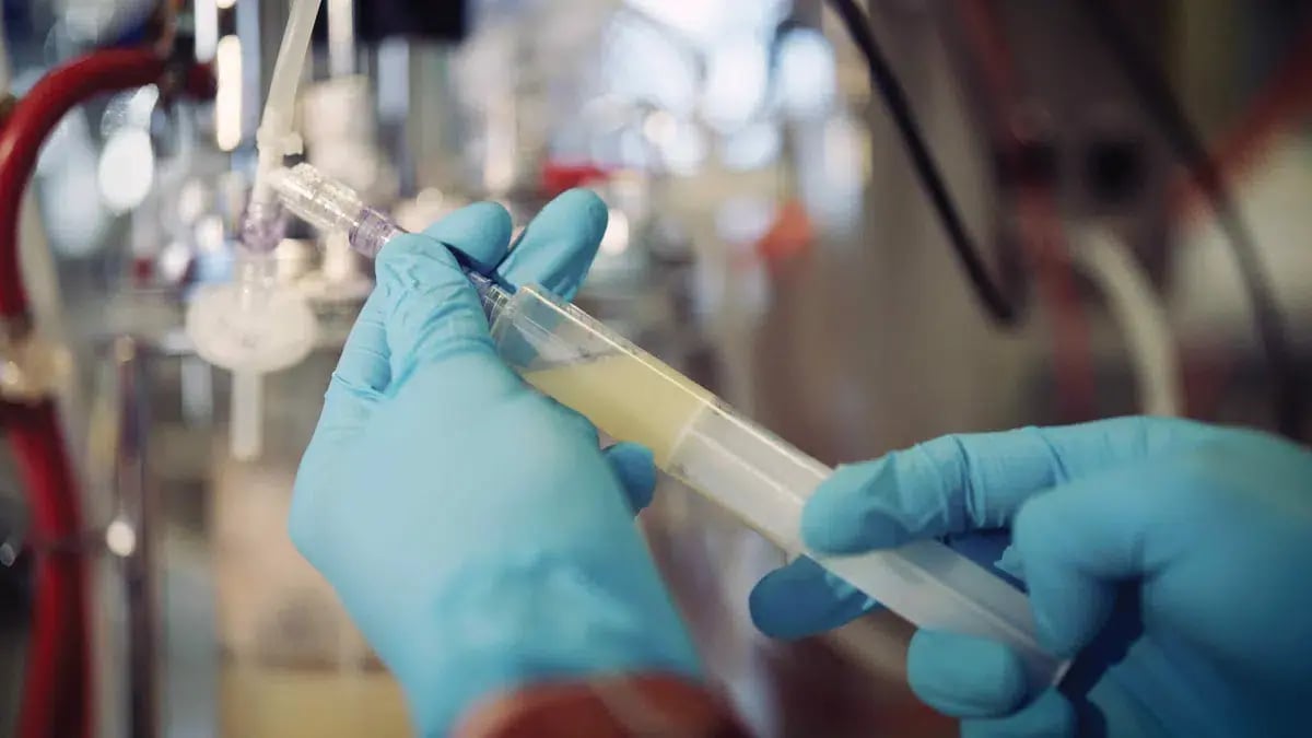 Bacteria Alternate_Bioreactor sample_7